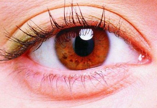 如何去除額頭皺紋？日常小妙招和熱門輕醫(yī)美方式分享！