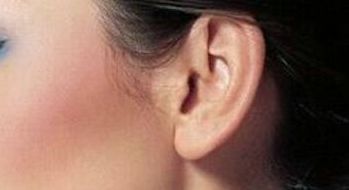 雙眼皮修復(fù)后的護(hù)理推薦