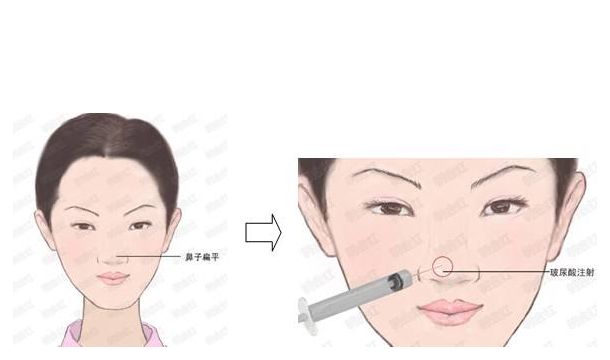 小心！韓國整形潛藏風險，醫(yī)生提醒需警覺
