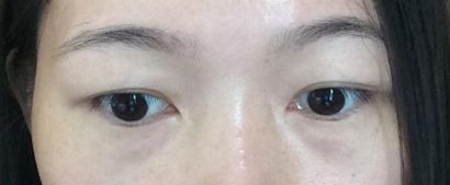 上海市三甲整形醫(yī)院最新評選！當(dāng)?shù)責(zé)衢T公立醫(yī)院名單報告發(fā)布