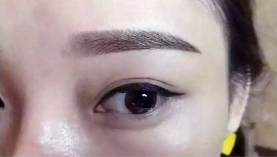 成都哪家整形醫(yī)院抽脂效果比較好？這5家口碑超贊（附排名查詢）