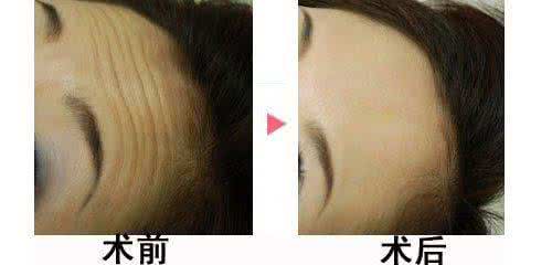 2023年貴陽哪家醫(yī)院背部抽脂術(shù)技術(shù)最實力？排名前十的醫(yī)療美容機構(gòu)比較！