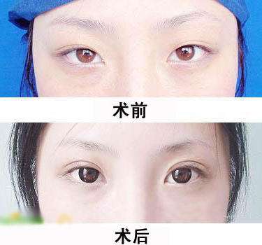 2023深圳彩光祛斑醫(yī)院排名前10強，解放您的肌膚煩惱！
