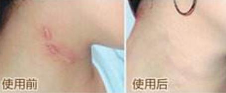 上海眼底紋去除排行榜：10家美容醫(yī)院內(nèi)幕揭秘！