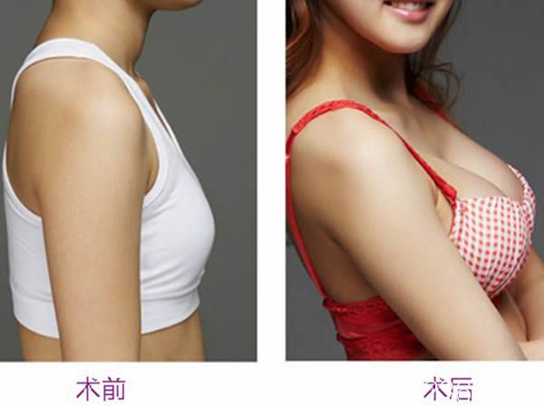 貴陽眼部整形醫(yī)院排名榜單，專業(yè)眼袋去除技術(shù)哪家強(qiáng)？