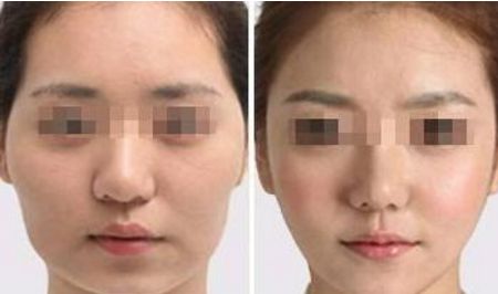 長(zhǎng)沙隆鼻哪家強(qiáng)？榜上有名的十佳整形醫(yī)院推薦