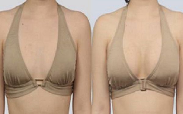 在杭州尋求巨乳縮小手術(shù)的可信醫(yī)院推薦