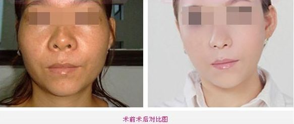 擁有漂亮濃密睫毛的方法與養(yǎng)護指南有哪些