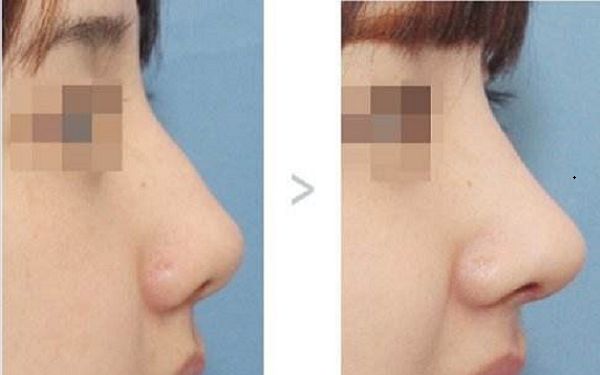 昆明醫(yī)美整形機構(gòu)大比拼：吳氏嘉美 VS 華美美萊