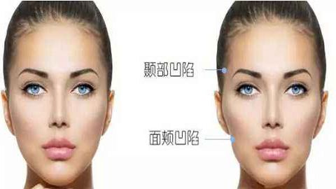 杭州專業(yè)整形磨骨醫(yī)院推薦｜顛覆時光，打造完美臉型