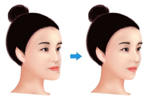 華南地區(qū)熱門整形醫(yī)院公開揭曉，溫州專業(yè)醫(yī)療機構(gòu)實力備受關注！