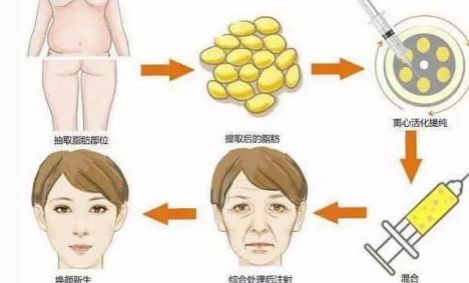 醫(yī)療界熱議！權(quán)威整形機(jī)構(gòu)推薦這些專業(yè)吸脂醫(yī)院！