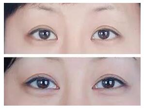 2023年，天津頗具聲譽的面部拉皮整形技術(shù)醫(yī)院有哪些？天津拉皮美容名醫(yī)院十佳醫(yī)院推薦合輯！