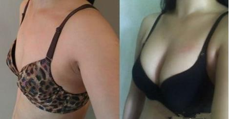 太原傾城醫(yī)療美容診所的熱門整形項(xiàng)目有哪些？