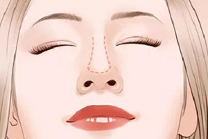 長沙頂尖隆鼻整形醫(yī)院集錦，醫(yī)學(xué)專家推薦的前七強(qiáng)！