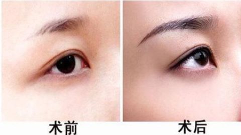 2023年北京腿部吸脂修復(fù)，深受青睞的專家推薦，錯(cuò)過(guò)可惜?。?>
										</a>
										<div   id=