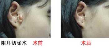 常德最值得信賴的前10家童顏彈力注射醫(yī)院