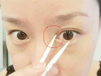 長(zhǎng)沙美德思醫(yī)療美容值得信賴嗎？拋開(kāi)疑慮，你了解這些整形知識(shí)嗎？