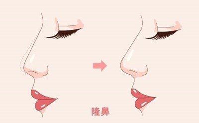 三亞消除眼部皺紋 十大口碑醫(yī)美機(jī)構(gòu)揭秘