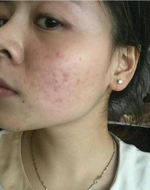 成都哪家醫(yī)院線雕蘋果肌效果好？TOP10排名揭秘