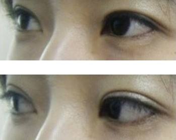 內(nèi)蒙古腰腹溶脂針手術(shù)哪家整形醫(yī)院靠前？2023年內(nèi)蒙古腰腹溶脂針魅力美容機(jī)構(gòu)薈萃！