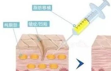 陽光、連天美、檸櫟、芙洛拉，哪家是義烏整形醫(yī)院獨(dú)孤求?。俊?023最新榜單揭秘】