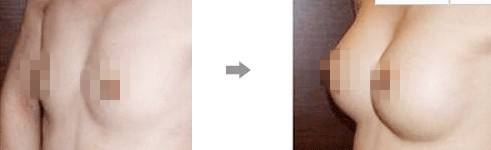鄭州哪家整形醫(yī)院自體脂肪注射肥胖紋效果好？ Top10排名揭曉