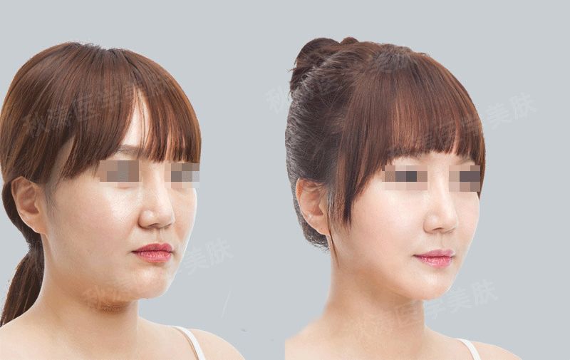 2023年很受歡迎的鄭州瘦小腿醫(yī)療美容醫(yī)院推薦名單即將揭曉！