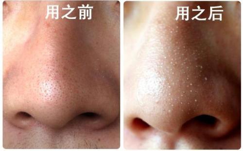 2023年駐馬店自體脂肪隆乳排名前10名醫(yī)院推薦！