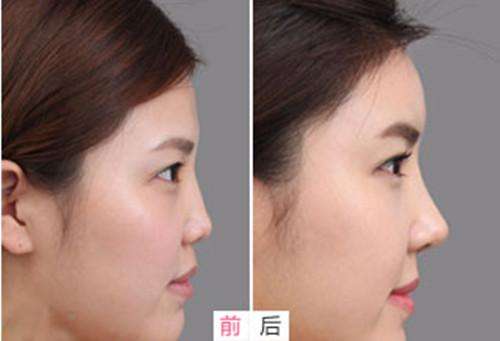 梅州愛麗諾韓美醫(yī)療美容門診部技術(shù)如何？擁有具備專業(yè)素養(yǎng)的醫(yī)生？