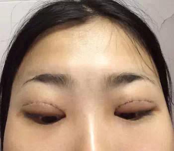 哪家揚(yáng)州深藍(lán)熱塑射頻除皺整形醫(yī)院值得推薦？2023年十大熱塑射頻除皺醫(yī)院盤點(diǎn)！
