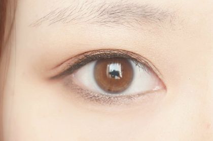 濟(jì)寧有哪些靠譜的雙眼皮手術(shù)醫(yī)院值得推薦？