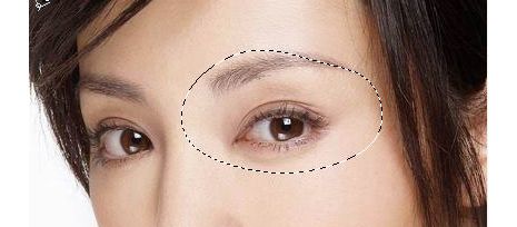 如何選擇太原去黃褐斑的醫(yī)院？推薦一家口碑好、專業(yè)的太原去黃褐斑醫(yī)院！