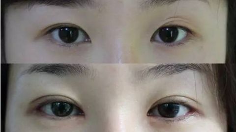 成都治療O型腿哪家醫(yī)院好？選擇靠譜醫(yī)院，細(xì)致引導(dǎo)具體調(diào)整-就到某某醫(yī)院！