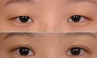 北京惠合嘉美醫(yī)療美容診所信譽(yù)如何？可靠嗎？患者對(duì)醫(yī)生口碑的全新評(píng)價(jià)！