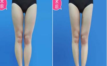 廣州唇部整形醫(yī)院推薦排行榜出爐，口碑走俏的幾家醫(yī)院全揭秘