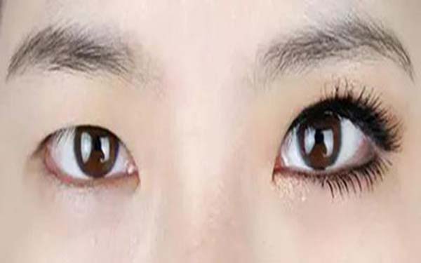2023攀枝花眼袋整容醫(yī)院推薦，哪家聲譽(yù)口碑？