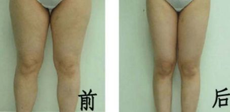 武漢最佳玻尿酸注射醫(yī)院排名揭曉！這三家醫(yī)院值得您的關(guān)注！