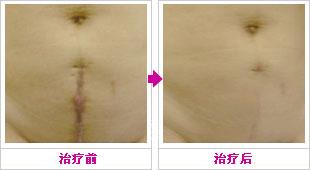 四川扎根無創(chuàng)瘦臉整形醫(yī)院哪些效果受認(rèn)可？2023年排行前十家尤其突出！