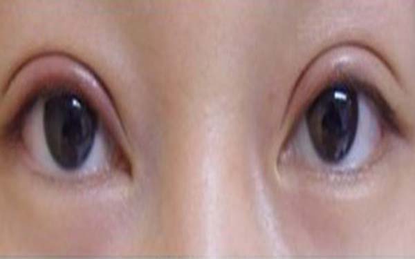 溫州下巴后縮矯正醫(yī)療美容醫(yī)院推薦！2023年TOP10非常受歡迎的醫(yī)院排行榜！探究其魅力！