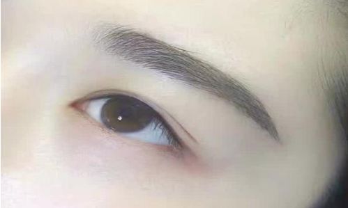 南京哪家整形醫(yī)院的玻尿酸隆鼻效果最佳？附南京整形醫(yī)院排行榜前十一名單