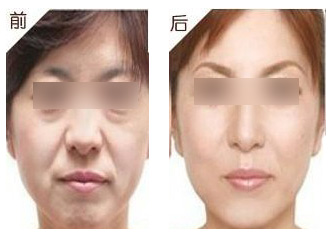 2023年蘇州暢銷的整形美容醫(yī)院排行榜出爐，解決生長紋好評如潮！
