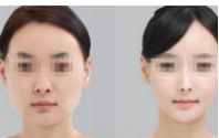 四川省第一醫(yī)院整形科口碑怎么樣？醫(yī)院概況及收費標(biāo)準(zhǔn)