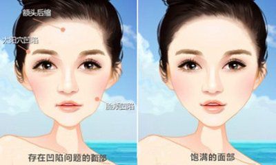 蕪湖眼科整形醫(yī)生推薦的眼部修復(fù)方法