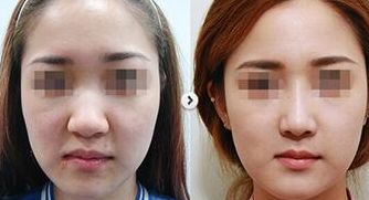 常德眼角修復(fù)專家推薦