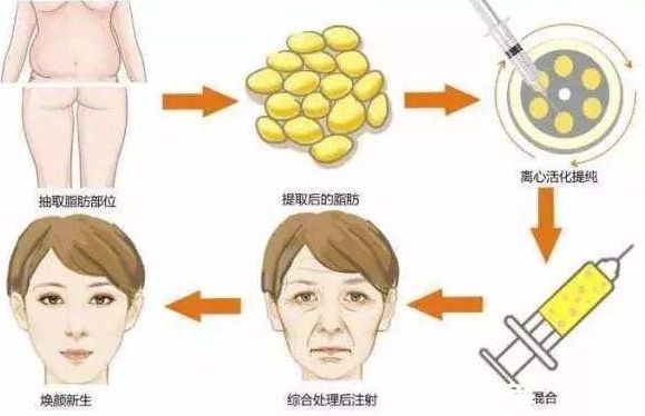 長春面部提升醫(yī)院權(quán)威指南：十佳機(jī)構(gòu)大盤點