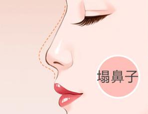 煙臺環(huán)形定向吸脂整形美容醫(yī)院排名Top10揭曉！