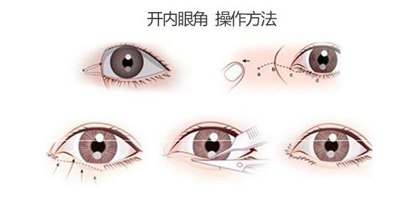 去皺煥顏揭秘！上?？诒笆目谥芗y整形醫(yī)院良心推薦