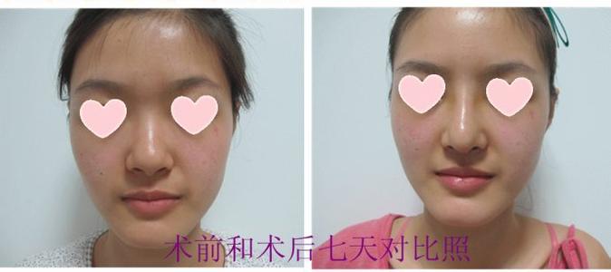 徐州治療疤痕很好的整形美容醫(yī)院推薦！2023年徐州鐳射祛疤醫(yī)院排行榜前十強！
