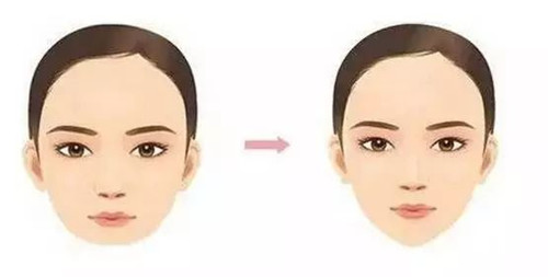 杭州智美顏的特色項目是什么？有哪些醫(yī)生會推薦呢？